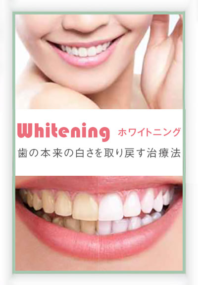 ホワイトニング　歯の本来の白さを取り戻す治療法